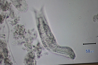 胴部が太く尾部は細く二股に分かれたカエトノツスの様な形をした微生物の写真