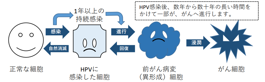 HPV感染と子宮頸がんの発生の流れ