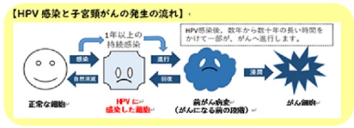 HPV感染と子宮頸がんの発生の流れ